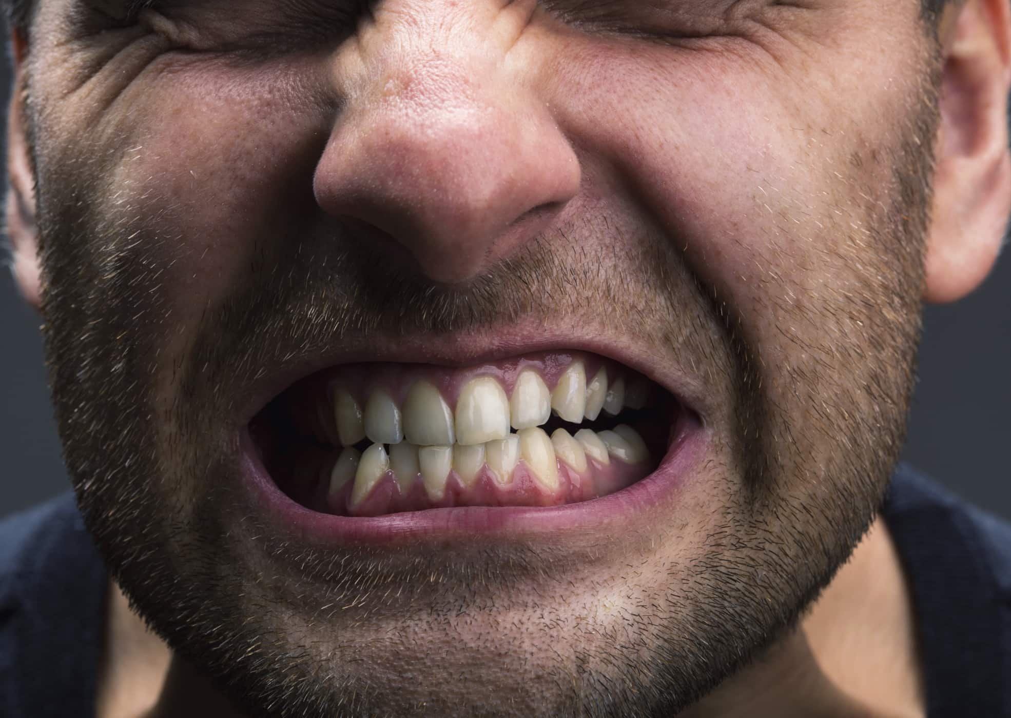 3 troubles de la bouche causés par le stress