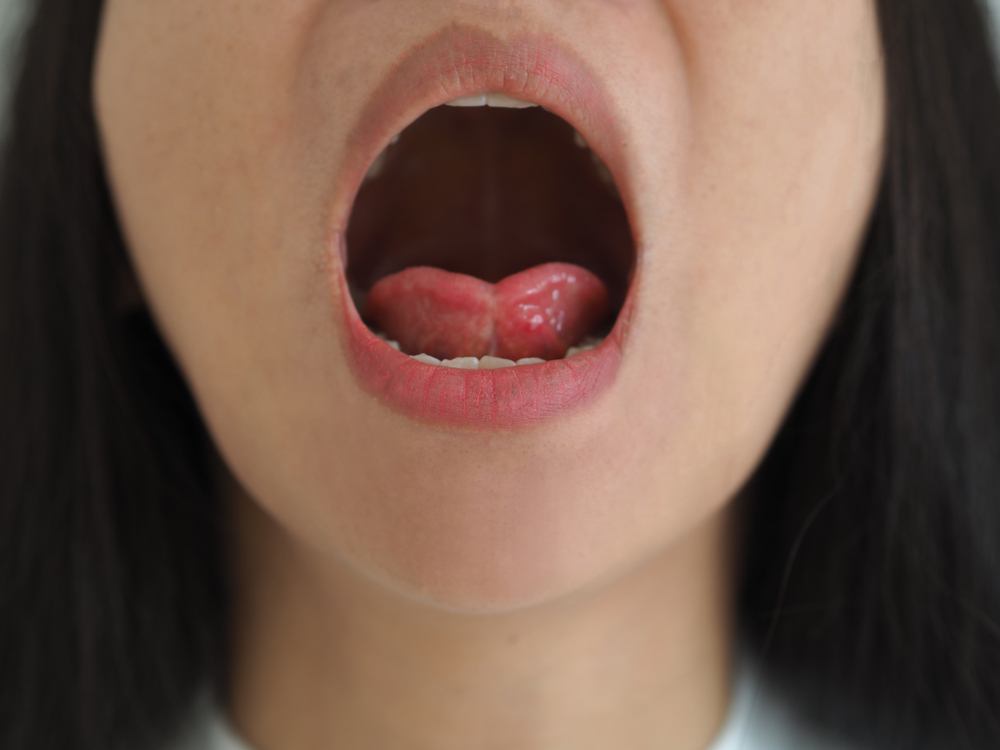 Progutani jezik
