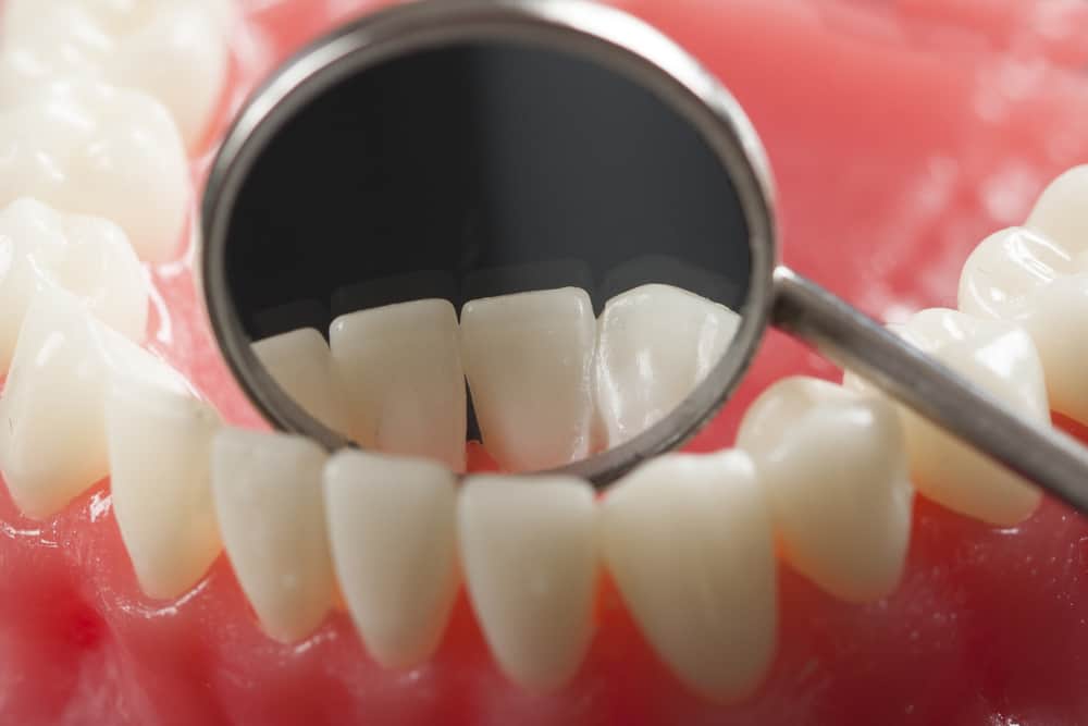 Curățarea dinților cu Waterpik și ața dentară: care este mai bine?