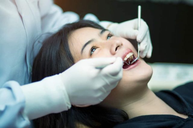Quel est le bon moment pour le détartrage dentaire ?