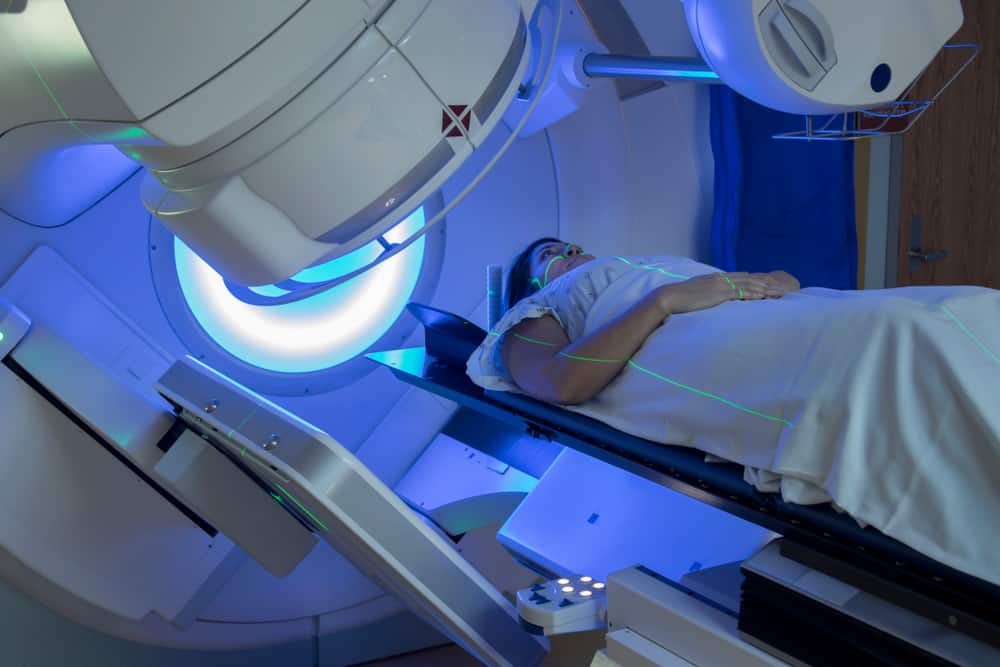 Kakva je radioterapija raka dojke i kada je potrebna?
