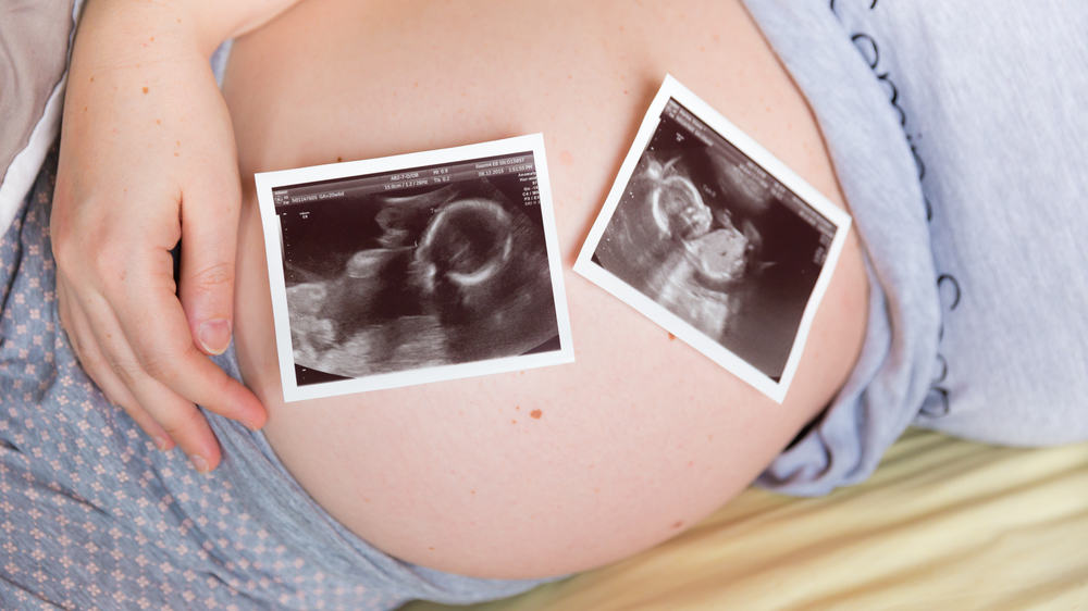 Vanishing Twin Syndrome : quand les jumeaux disparaissent de l'utérus