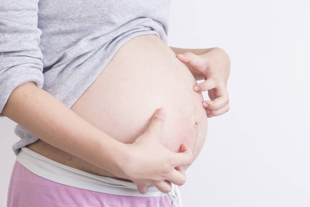 6 effectieve manieren om jeuk te overwinnen tijdens de zwangerschap als gevolg van prurigo