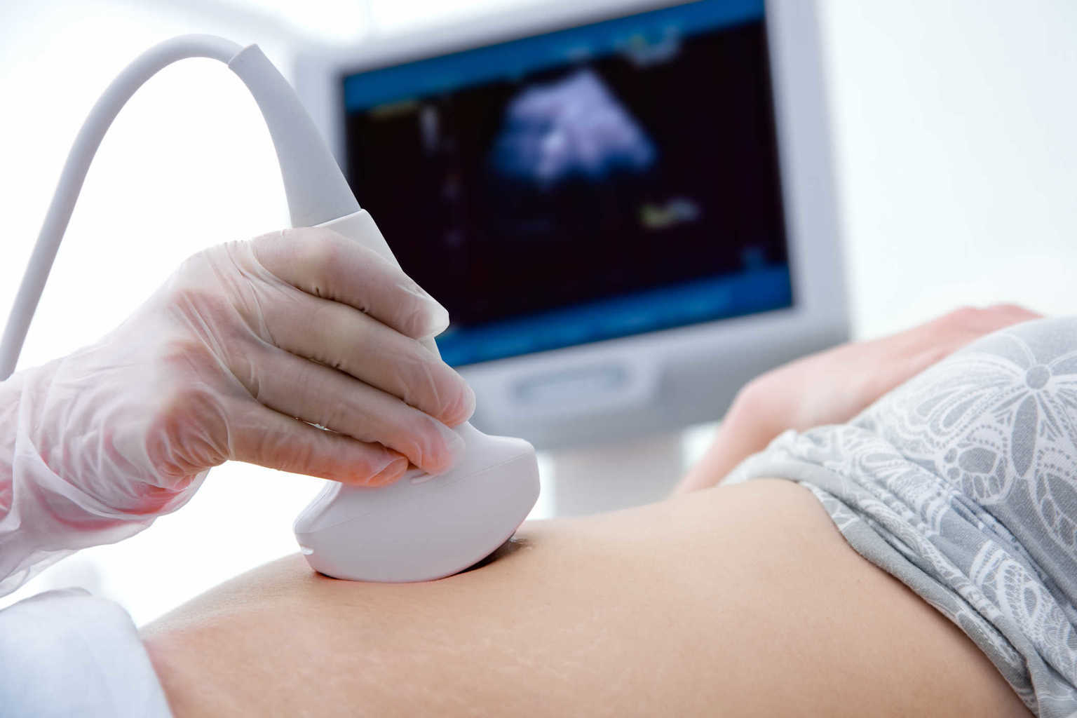임산부의 심장병에 대한 4가지 일반적인 질문