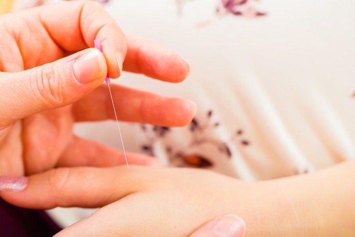 Akupunktura tijekom trudnoće, koje su prednosti i rizici?