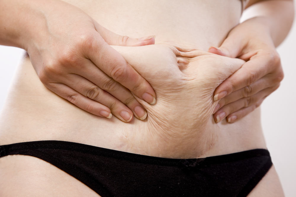 4 Veränderungen, die am Körper einer Frau nach der Geburt passieren