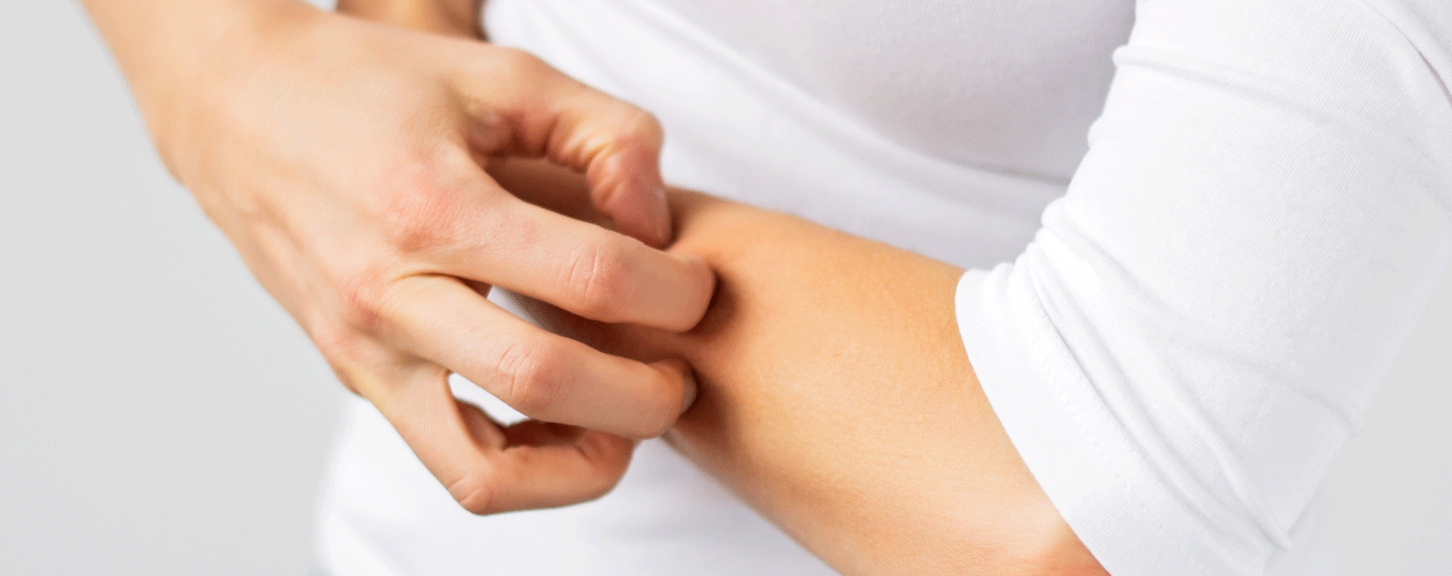 Uzroci i kako liječiti gljivice na koži i noktima