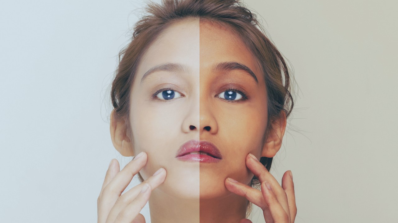 의사의 치료를 사용하여 얼굴 피부를 희게하는 3가지 방법
