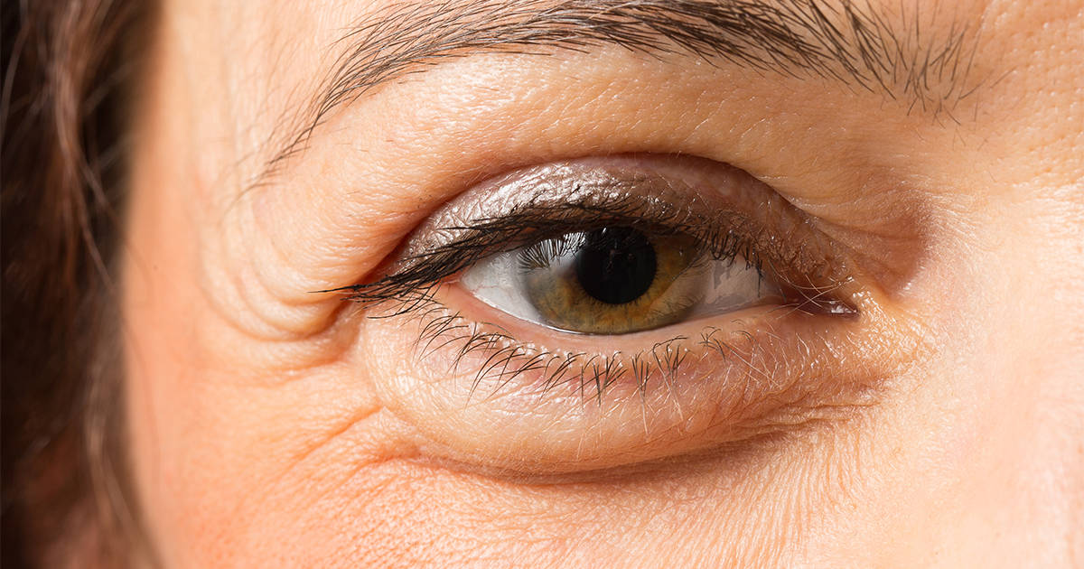 Čuvajte se 7 vrsta glaukoma koji se mogu pojaviti