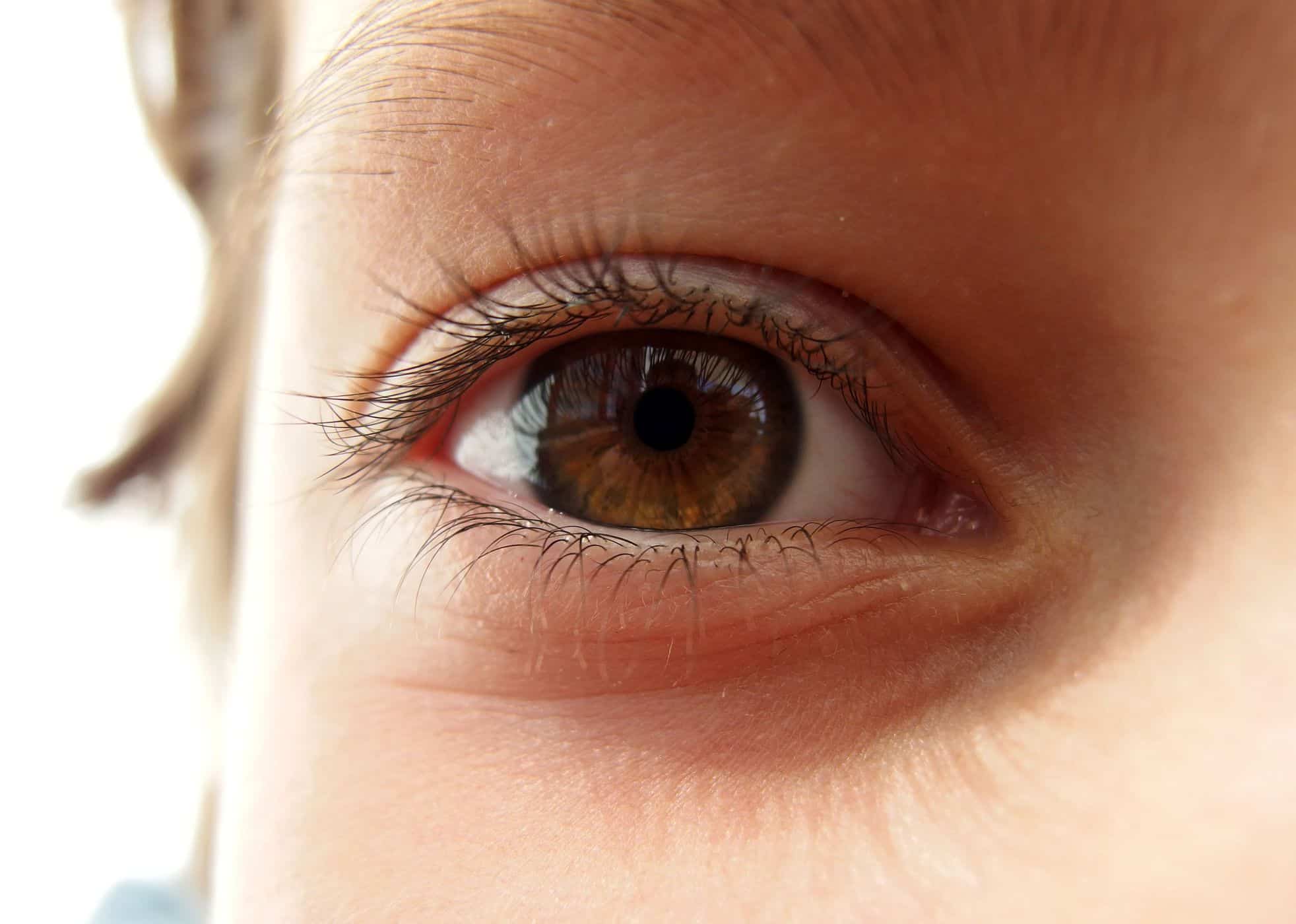 מדריך לטיפוח עיניים לאחר ניתוח לאסיק