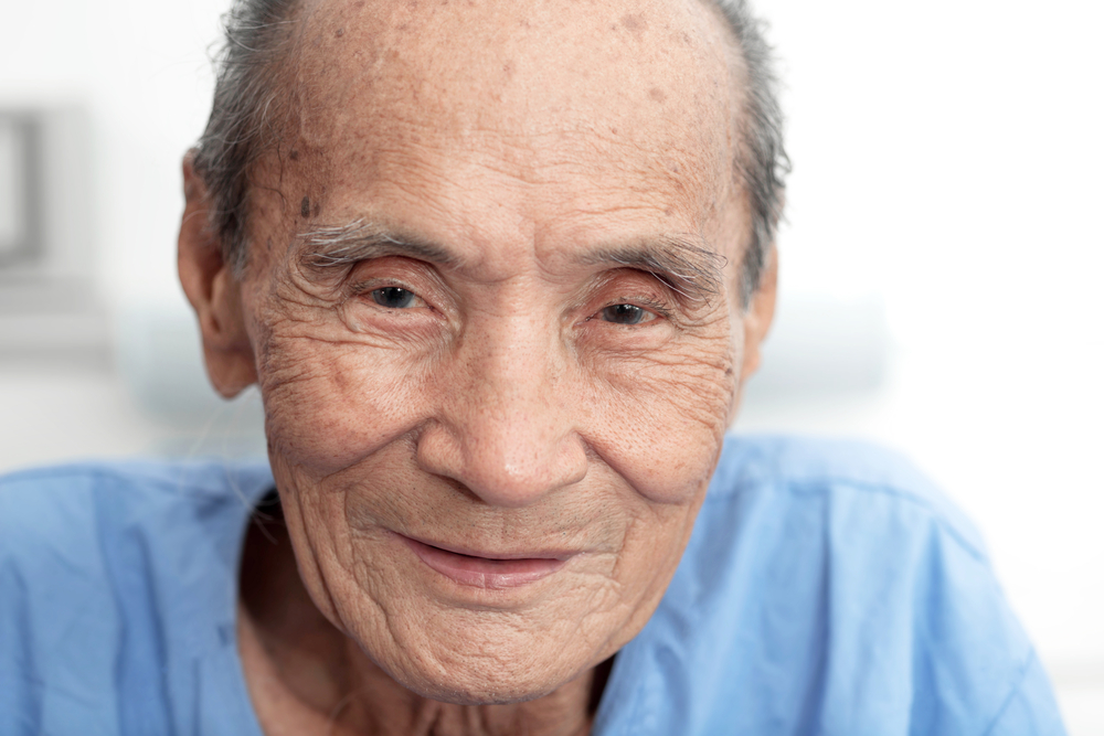 Causes et comment surmonter l'hyperlacrimation ou les yeux larmoyants chez les personnes âgées