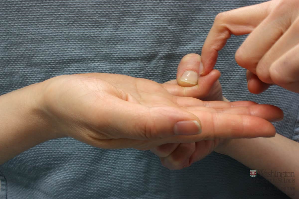 Degetul de ciocan