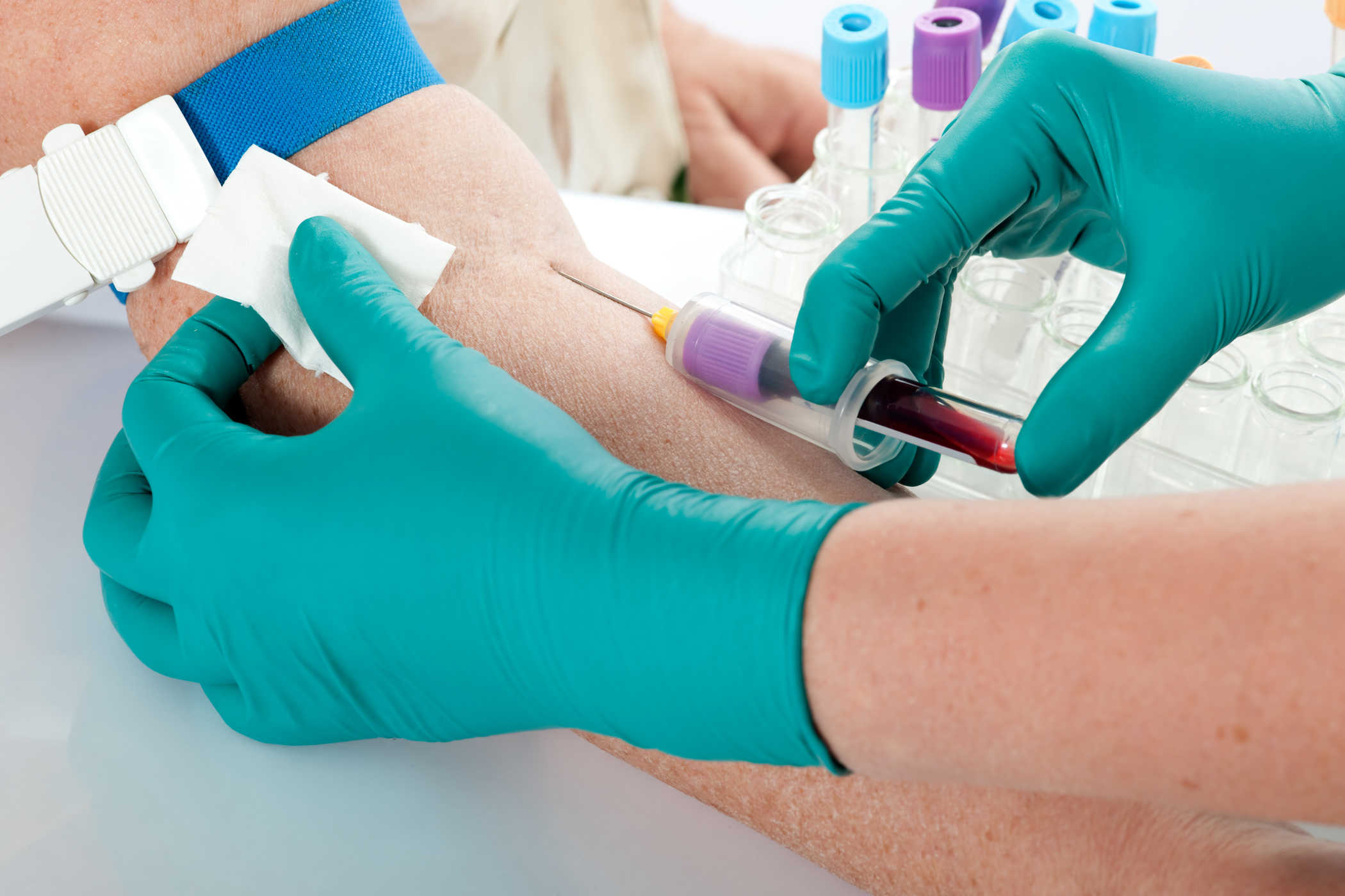 Cum funcționează testele funcției hepatice pentru a detecta riscul de afectare a ficatului