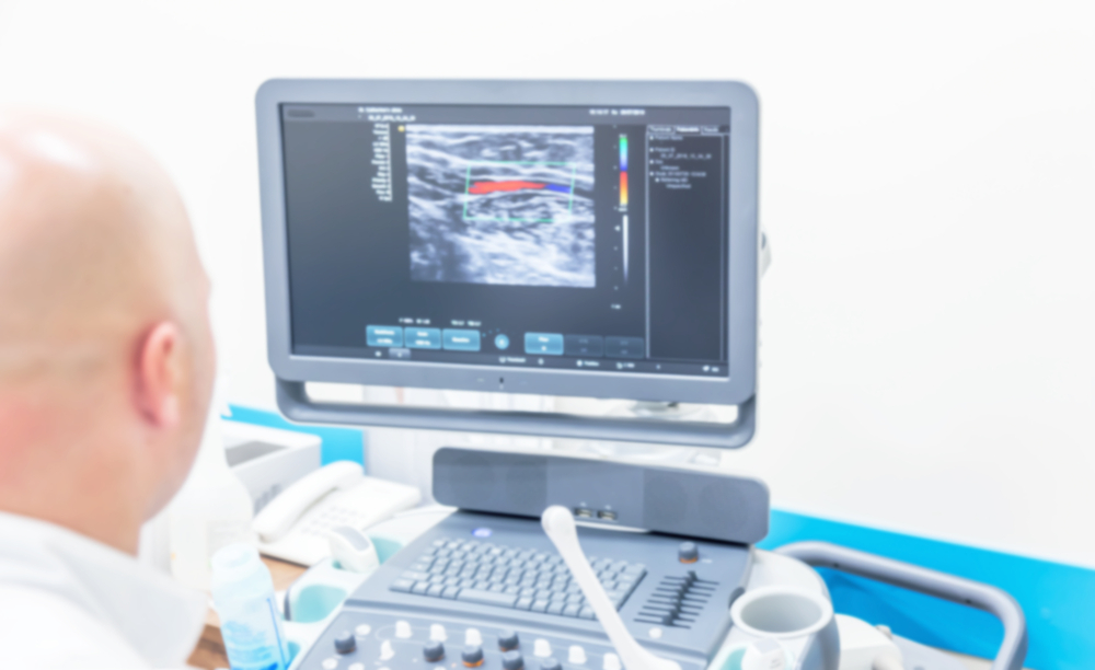 Potpuno oguliti problem transrektalnog ultrazvuka, metoda probira kroz anus (anus)