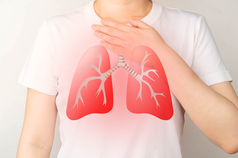 5 complications d'embolie pulmonaire potentiellement mortelles
