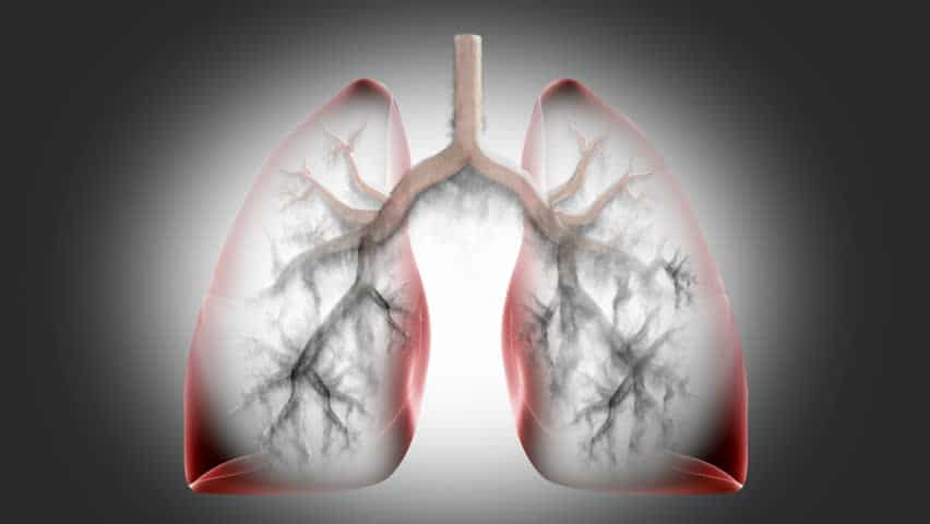 COPD 예방 및 발병 시 상태가 악화되는 것을 예방하는 방법
