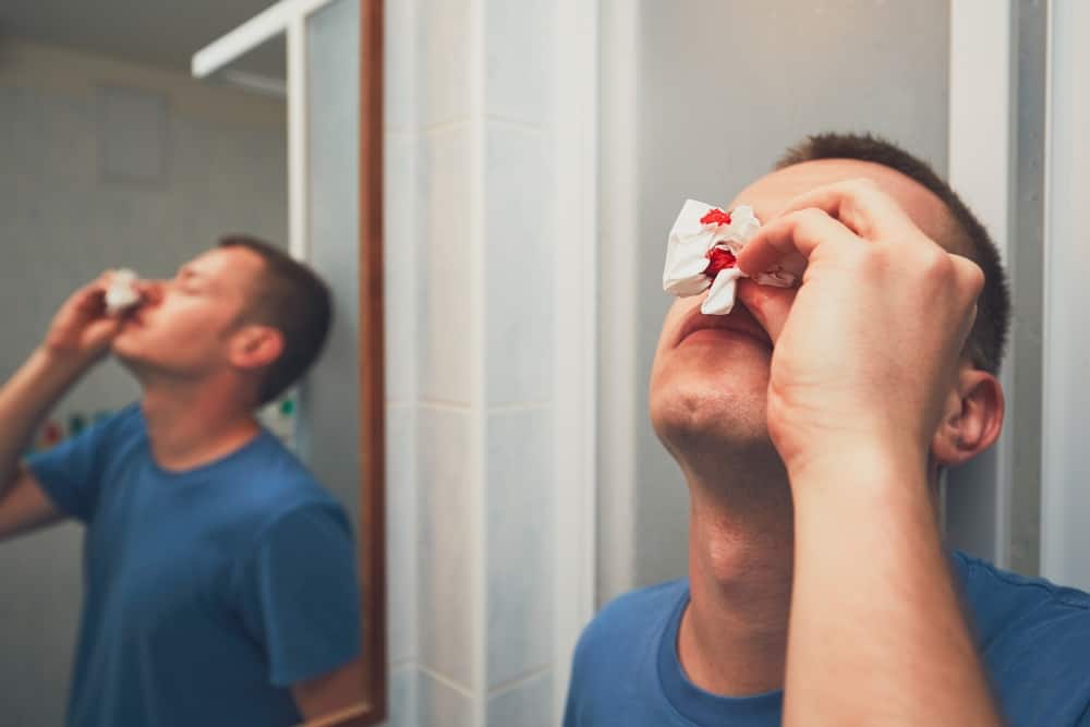 Može li podizanje glave zaista zaustaviti krvarenje iz nosa?