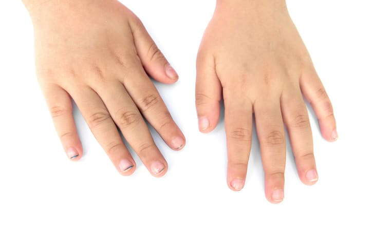 C'est le résultat si les ongles de votre enfant ne sont pas coupés régulièrement