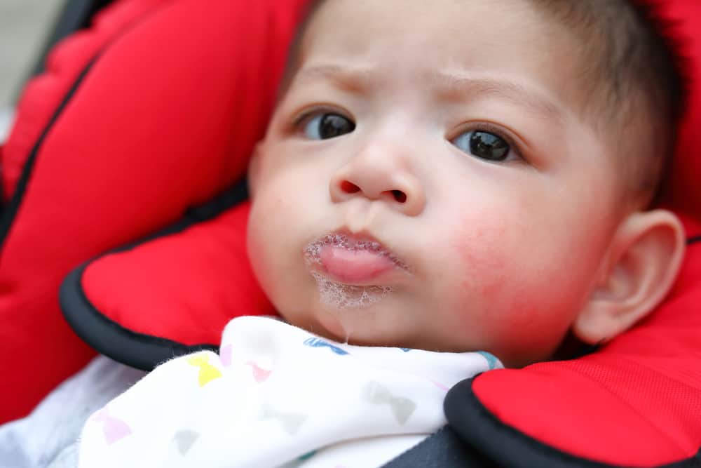 Hautausschlag bei Babys? Keine Panik, vielleicht ist das das Ergebnis des Sabberns Ihres Kleinen