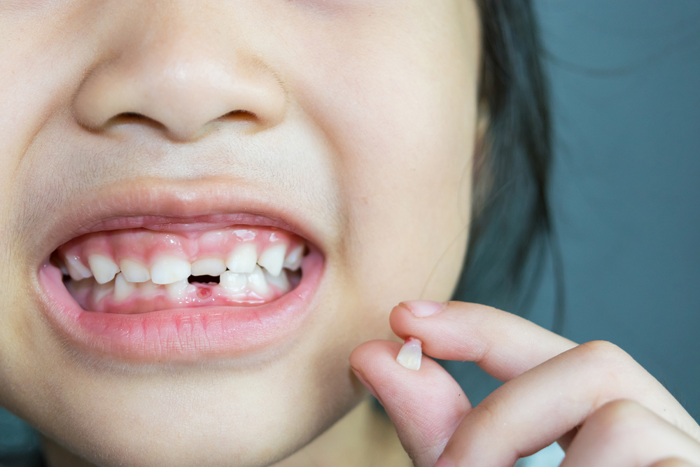 När faller ditt barns tänder ut för första gången?