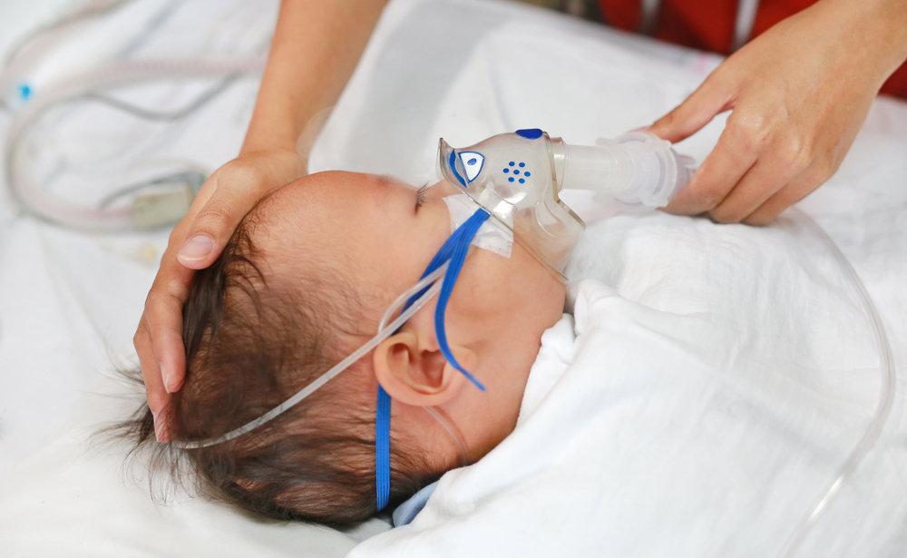 RDS chez les nourrissons, syndrome respiratoire de la naissance prématurée