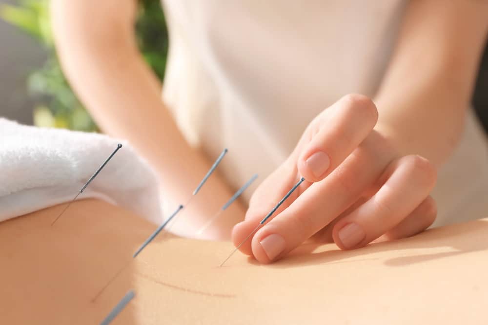L'acupuncture s'avère bénéfique pour ces 4 conditions