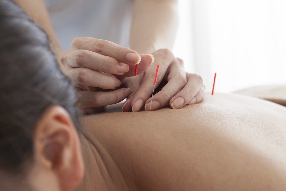 Haben Sie Akupunktur für Schwangere-Programme ausprobiert?