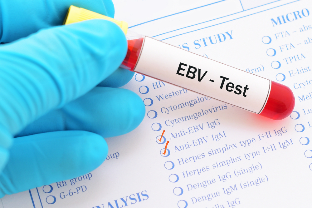 연구에 따르면 Epstein-Barr 바이러스가 7가지 심각한 질병을 유발할 수 있음