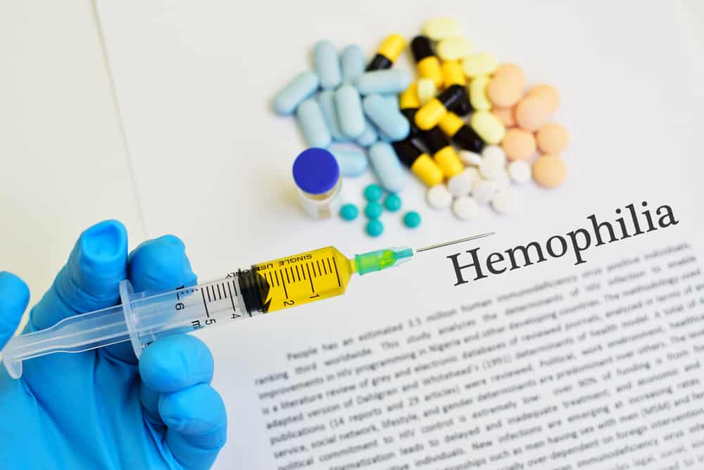 Behandlingsalternativ för hemofili för att behandla symtom